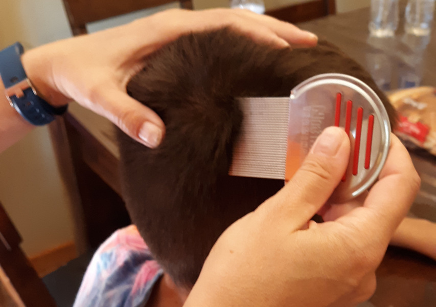 Head Lice In School Guide For Schools and Parents LiceDoctors